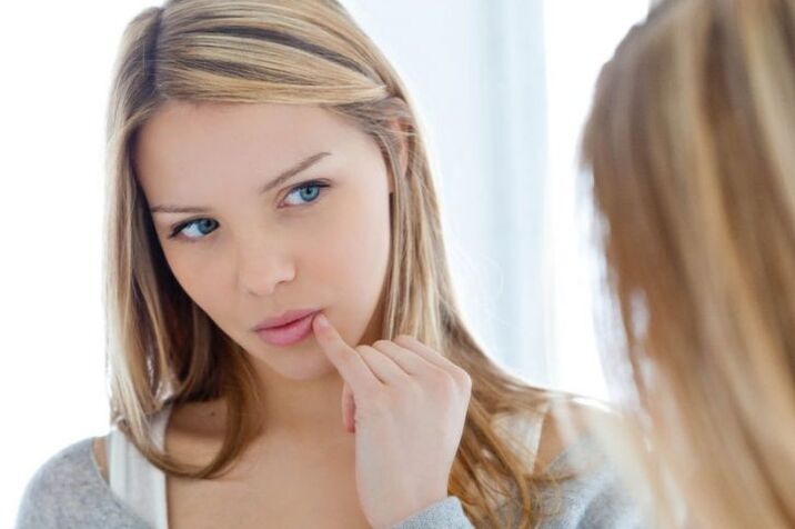 κονδυλωμάτων στο χείλος ενός κοριτσιού πώς να αφαιρέσετε