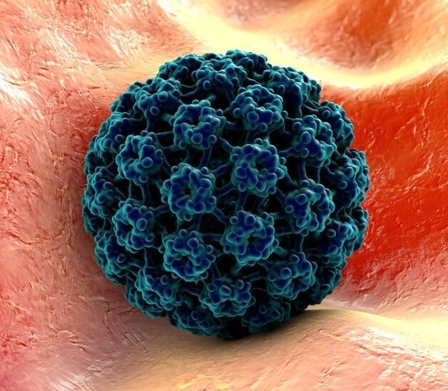 Τρισδιάστατο μοντέλο HPV που προκαλεί κονδυλώματα στα χέρια
